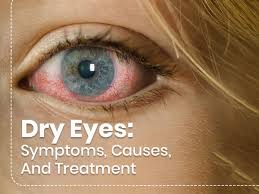 Dry eye atau Masalah mata kering.